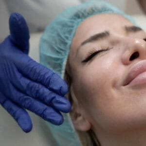 Clinica Noelia Gon - Medicina Estetica Facial - Peeling con Fenol TCA