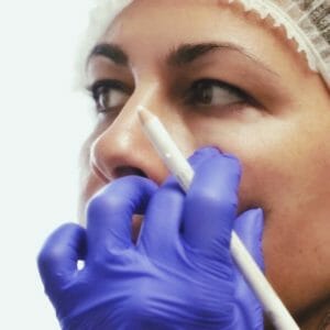 Clinica Noelia Gon - Medicina Estetica Facial - Sculptra
